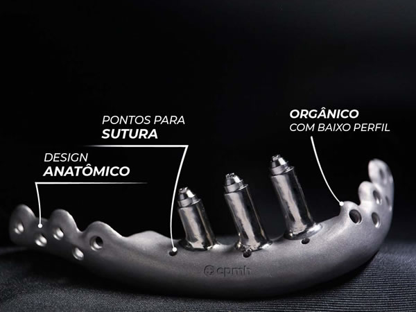 Reconstrução De Mandibula Sob Medida