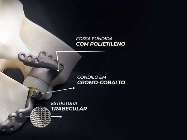 ATM - Sob medida - Fossa de polietileno com vitamina e